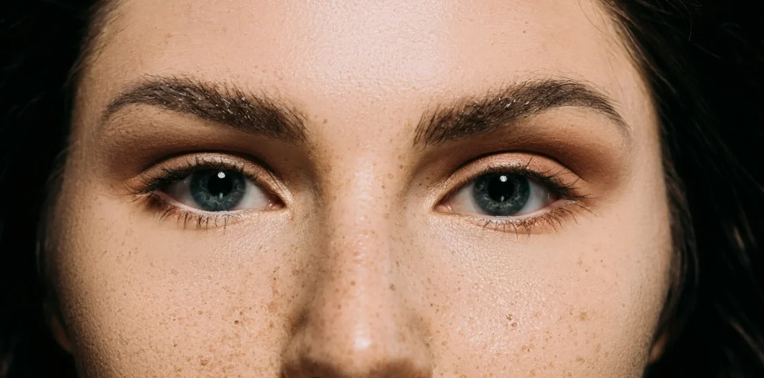 close up of attractive girl with freckles on face